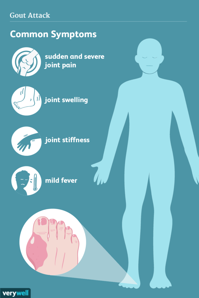 end of gout reviews